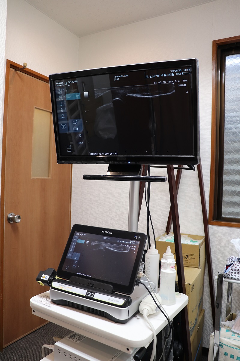 超音波エコー装置